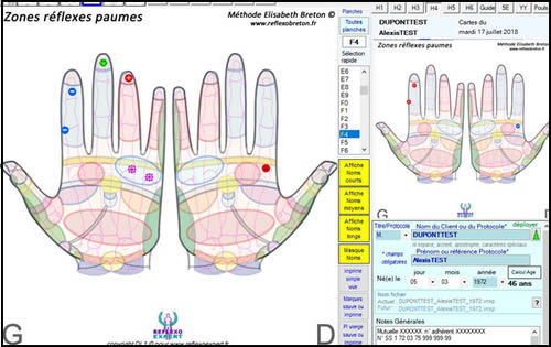 Suivi du patient ReflexoEXPERT